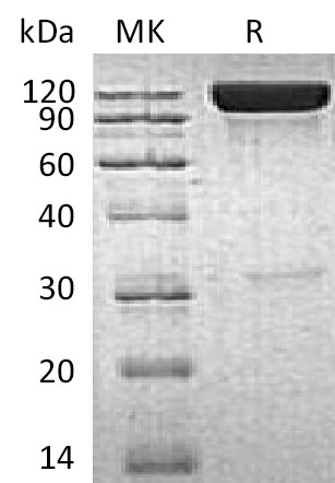 Human ICAM-1 +SDS-PAGE-2.jpg